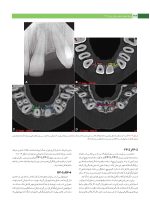 پروتز ایمپلنت های دندانی میش ۲۰۱۵ ج ۲ (سیاه و سفید) - Image 13
