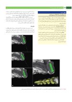 پروتز ایمپلنت های دندانی میش ۲۰۱۵ ج ۲ (سیاه و سفید) - Image 14