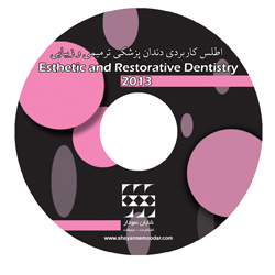 اطلس کاربردی دندانپزشکی ترمیمی و زیبایی ۲۰۱۳ CD-PDF