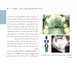 گام به گام با میکروایمپلنت_Page_14 گام به گام با میکروایمپلنت - Image 2