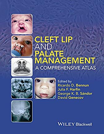 Cleft Lip and Palate Management A Comprehensive Atlas