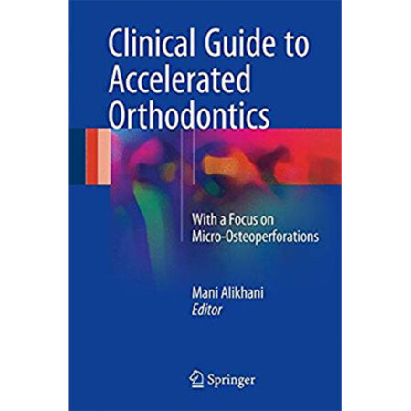 Clinical Guide to Accelerated Orthodontics With a Focus on Micro- Osteoperforations