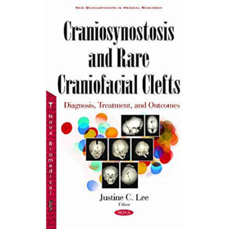Craniosynostosis and Rare Craniofacial Clefts: Diagnosis, Treatment and Outcomes