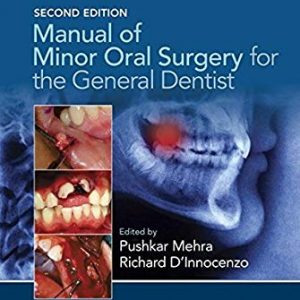 Manual of Minor Oral Surgery  for the General Dentist