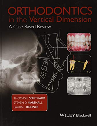 Orthodontics in the Vertical Dimension A Case‐Based Review