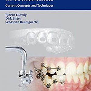 (Self-ligating Brackets in Orthodontics Current Concepts and Techniques (Thieme