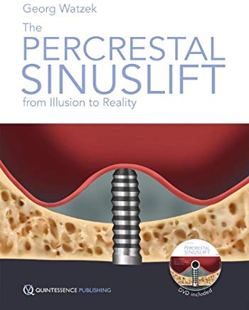The Percrestal Sinuslift From Illusion to Reality