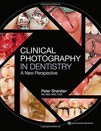 Clinical Photography in Dentistry: A New Perspective