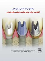 راهنمای مراحل کلینیکی و لابراتواری انتخاب و آمادهسازی اباتمنت ایمپلنتهای دندانی