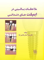 ملاحظات بالینی در ایمپلنت های دندانی