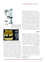 افزایش ابعاد استخوان در دندانپزشکی ایمپلنت 2019 - Image 5