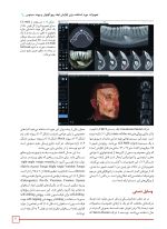 افزایش ابعاد استخوان در دندانپزشکی ایمپلنت 2019 - Image 6