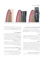 راهنمای کلینیکی و لابراتواری اباتمنت در ایمپلنت های دندانی - Image 5