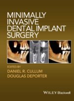 Minimally invasive dental implant surgery