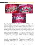 Profit j 3 color_Page_21 ارتودنسی معاصر پروفیت ۲۰۱۹ (جلد ۳) رنگی - Image 7