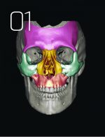 درمان جراحی شکستگی های فک و صورت 2019 - Image 4