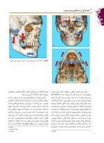 درمان جراحی شکستگی های فک و صورت 2019 - Image 6