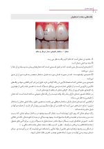 سپید خندان_Page_8 سپید خندان (روشهای طبیعی سفید کردن دندان) - Image 8