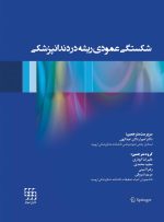 شکستگی عمودی ریشه در دندانپزشکی