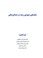 شکستگی عمودی ریشه در دندانپزشکی - Image 2