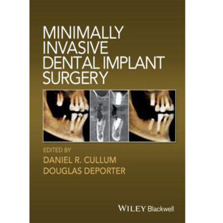 minimally invasive dental implant surgery