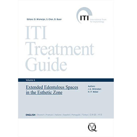 ITI Treatment Guid – Volume 6—Extended Edentulous Spaces in the Esthetic Zone