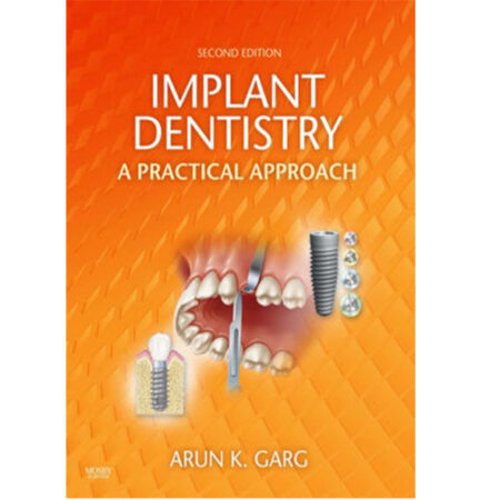 Implant Dentistry A Practical Approach