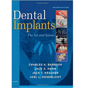 Dental Implant  the art and science