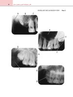 اطلس رادیوگرافیک آناتومی و پاتولوژی دندانی - Image 7