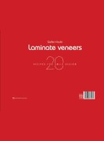 پرسلن لمینیت ونیر(20 طرح درمان برای بازسازی لبخند) - Image 11