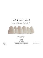 پرسلن لمینیت ونیر(20 طرح درمان برای بازسازی لبخند) - Image 10