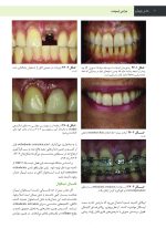 جراحی، دهان و فک و صورت فونسکا 2018 جلد پنجم (جراحی ایمپلنت) - Image 6