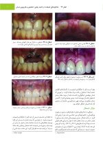 جراحی، دهان و فک و صورت فونسکا 2018 جلد پنجم (جراحی ایمپلنت) - Image 7