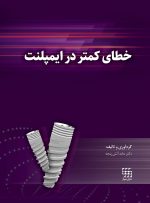 خطای کمتر در ایمپلنت