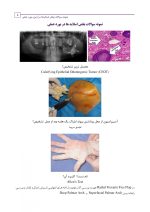 2 (5) نمونه سوالات بخش اسلایدها در آزمون بورد عملی جراحی دهان، فک و صورت - Image 6