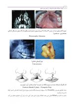 2 (8) نمونه سوالات بخش اسلایدها در آزمون بورد عملی جراحی دهان، فک و صورت - Image 7