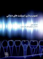 تصویربرداری ایمپلنت های دندانی - Image 7