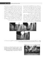 ENDO BLACK_Page_15 اصول و درمان اندودانتیکس ترابی نژاد 2021 (چاپ سیاه و سفید) - Image 11