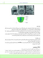 درسنامه ارتودنسی معاصر پروفیت 2019 جلد 1 و 2 (همراه با فیلم آموزشی) - Image 12