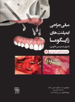 مبانی جراحی ایمپلنت های زایگوما (اصول دسترسی آناتومی)