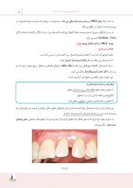 درسنامه پریودانتیکس کارانزا 2019 جلد 1 و 2 (همراه با فیلم آموزشی) (رفرنس آزمون ملی و سال های گذشته) - Image 6
