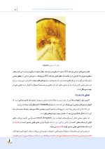 درسنامه ترمیمی (همراه با فیلم آموزشی) - Image 9