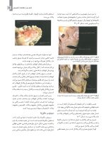 مبانی جراحی ایمپلنت های زایگوما (اصول دسترسی آناتومی) - Image 6