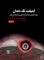 ایمپلنت تک دندان 2020