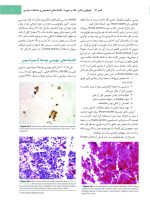 جراحی دهان،فک و صورت فونسکا 2018 جلد هفتم (پاتولوژی) - Image 6