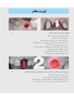 زیبایی شناسی بافت نرم و پرسلن های صورتی رنگ در درمان با ایمپلنت - Image 5