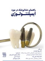 راهنمای دندانپزشک درمورد ایمپلنتولوژی