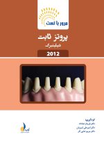 مرور با تست پروتز ثابت شیلینبرگ