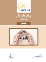 مرور با تست پروتز پارسیل مک کراکن
