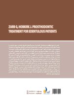 مرور با تست پروتز کامل زارب - Image 3